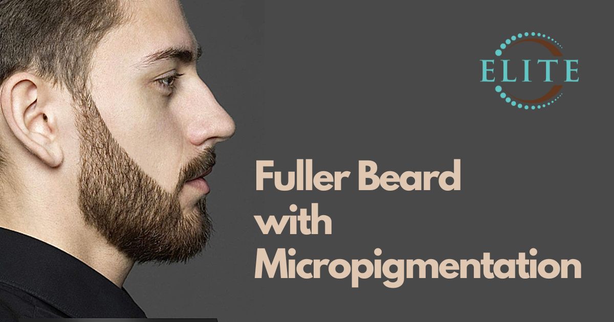 Fuller Beard with Micropigmentation
